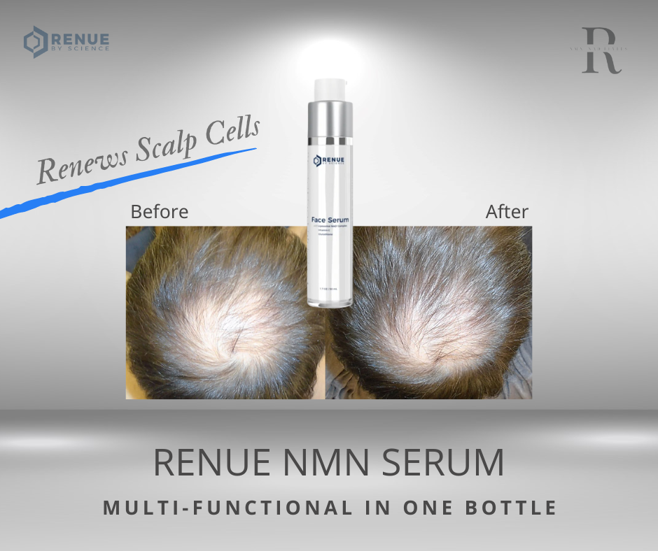[RENUE] RENUE™ Face Serum with Methylene Blue Liposomal Glutathione, Vitamin C (NAD+, NMN & NR