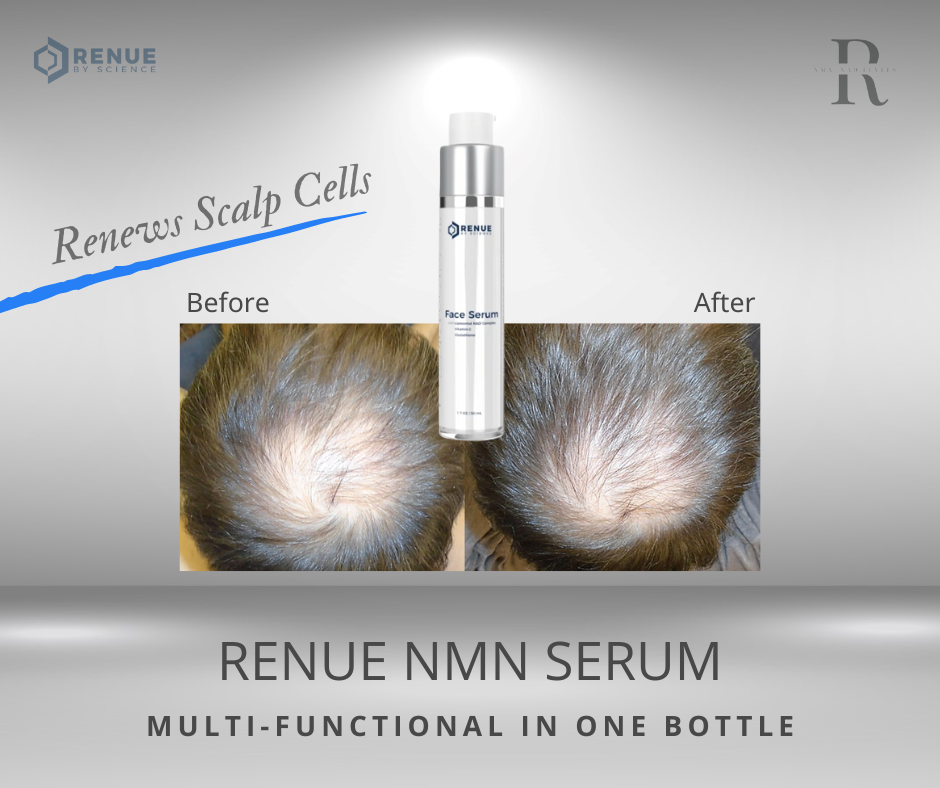 NMN: New Antiaging Booster - La Dermique Skin Care